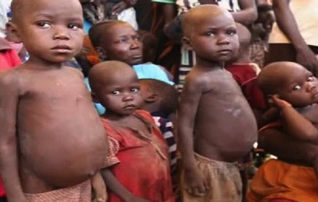 Malnourished children